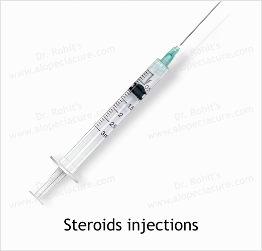 Steroids Injections
